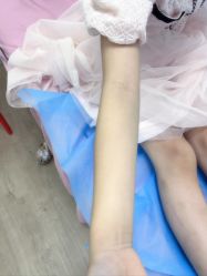 -貝康小儿推拿
