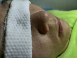 -苗医生0感祛痘连锁