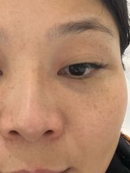 体验前-武汉颜范薇美医疗美容门诊部
