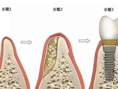 -上海市第五人民医院