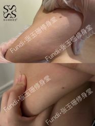 -Fundi张玉珊修身堂·indiba·BTL科技瘦身