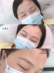 -久匠半永久纹眉