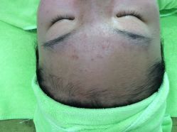 -苗医生草本科技祛痘