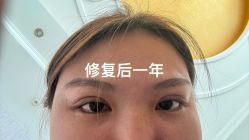-东莞壹加壹整形美容医院