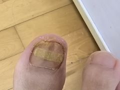 -郑远元专业修脚房(宣化路店)