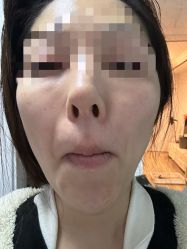 -上海玫瑰医疗美容医院