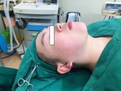 -洁铭新加坡医美