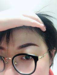 体验后-坤如玛丽·医疗美容中心