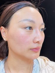 点击看大图 -广州美莱医疗美容医院