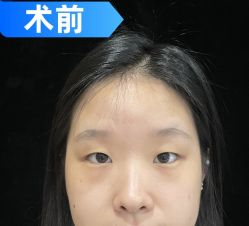 -素美医疗美容·西南眼鼻整形·修复基地
