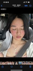 -深圳鹏爱秀琪医疗美容医院