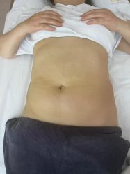 -Lily纤美·科技减脂中心