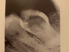 -上海市杨浦区牙病防治所