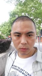 点击看大图 -大麦微针植发丨全国连锁