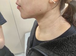 -Yestar艺星整形美容医院