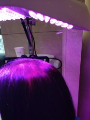 -碧莲盛·不剃发植发