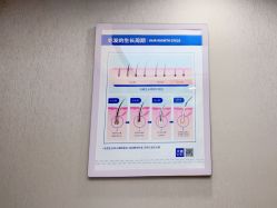 体验前-大麦微针植发全国连锁