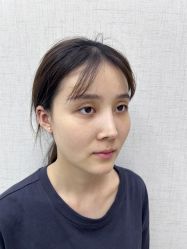 点击看大图 体验前-深圳艺星医疗美容医院