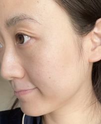 -比华利美容医院