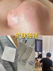 -skin79皮肤管理中心