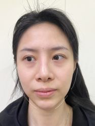 -Yestar杭州艺星医疗美容医院
