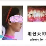 牙齿矫正好处不止一点点