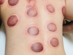 -宏强盲人推拿(永久路店)