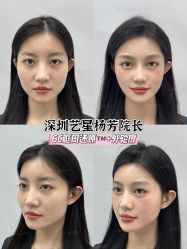 -深圳艺星医疗美容医院