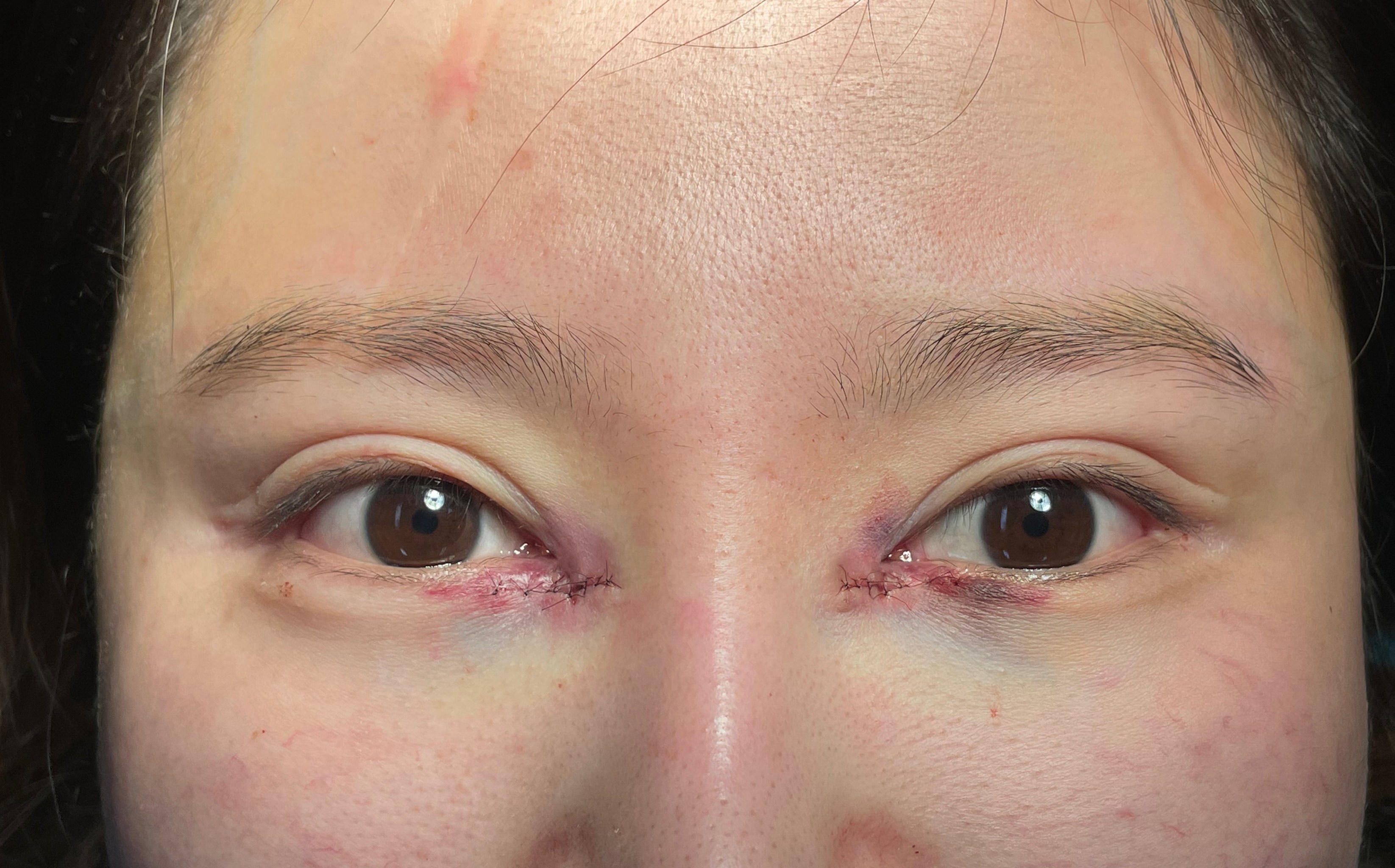 体验当天效果分享