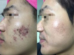 -苗医生专业祛痘·皮肤管理