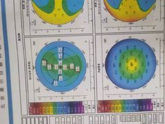 -美尔目眼科医院·近视手术·儿童近视(通州店)