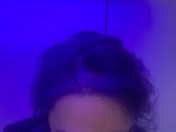 -熙朵美学植发·连锁品牌