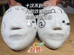 -小颜秘家·韩国整骨