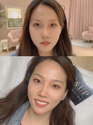 -UP&UP·半永久眉毛眼线机器野生眉