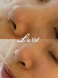 -LUNA皮相美·骨相美高级美感