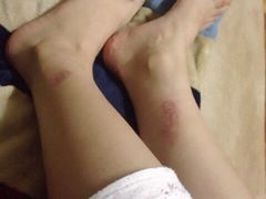 -莱蔻·圣灸堂·推拿艾灸(天山店)