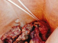 排骨酥肉双拼-傅强排骨(成都总店)