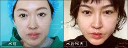 -北京丽星翼美医疗美容