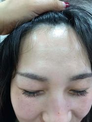 -美人痣全国连锁