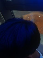 -碧莲盛·不剃发植发