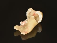 -精德口腔·种植修复·儿牙中心(财富中心店)