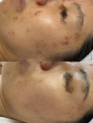 -康美贞·痘肌养护管理中心