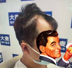 -大麦微针植发丨全国连锁