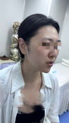 -海涛医疗美容·面部抗衰·注射美鼻