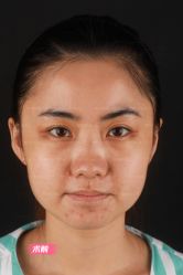 -北京米扬丽格医疗美容·联合丽格鼻整形中心