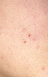 -万州华美紫馨整形美容医院