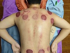 -沈师傅盲人按摩工作室(密三小区店)
