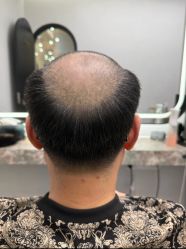 -唐风采假发补发定制