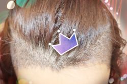 -大麦微针植发全国连锁