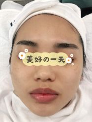-AiCure 埃可儿·韩国医学皮肤管理